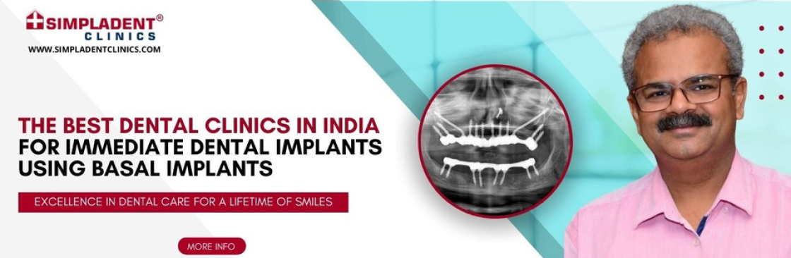 Implants Cost Dental Implants in India Cover Image