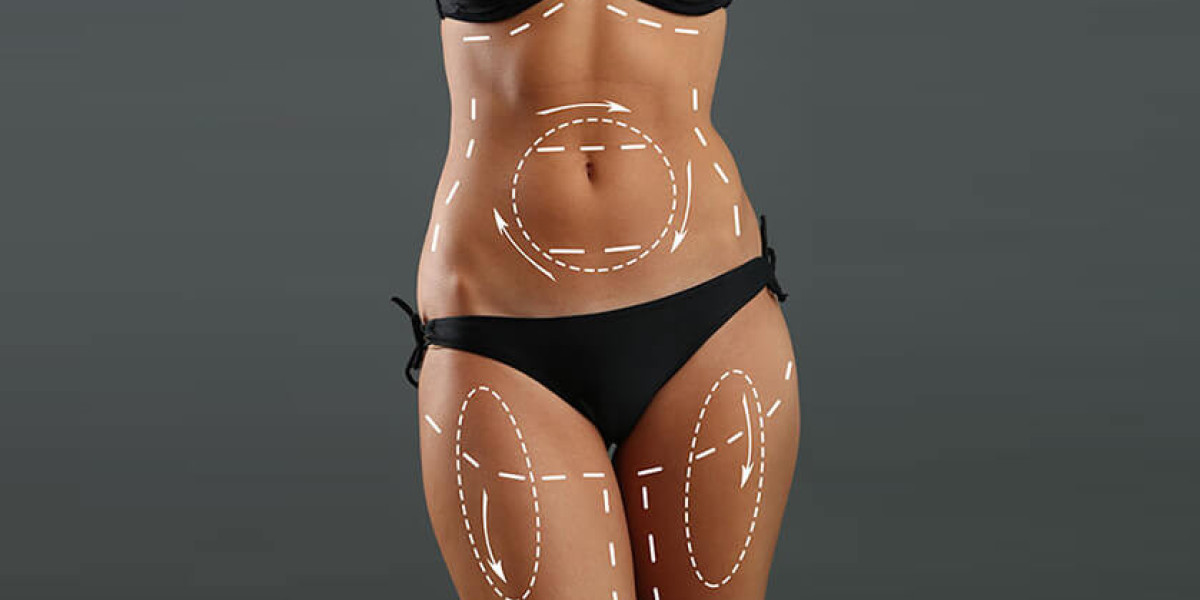 Liposuction Scars: What They Look Like and How to Minimize Them