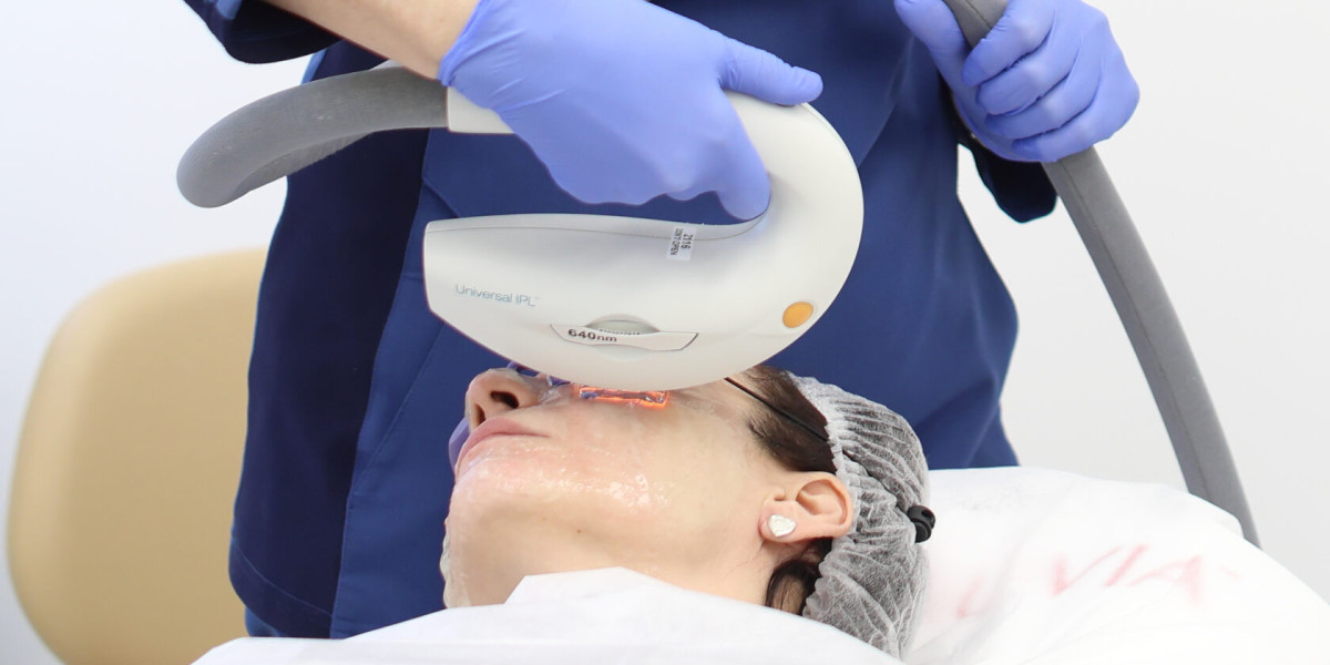 IPL Solutions for Dark Spots, Redness, and Skin Repair