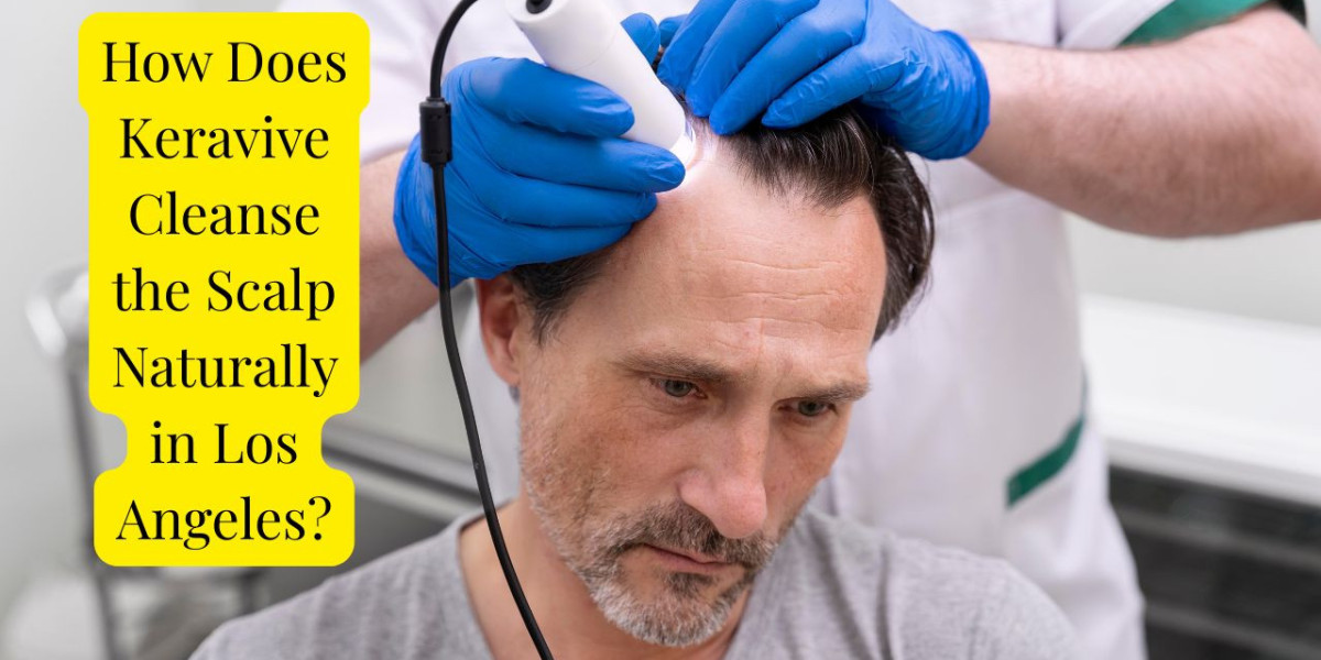 How Does Keravive Cleanse the Scalp Naturally in Los Angeles?