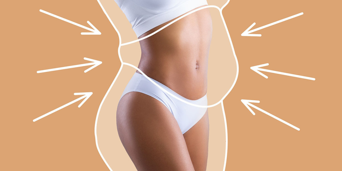 How Long Liposuction Results Last and How to Maintain Them