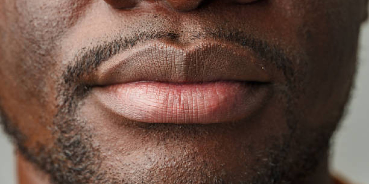Smoker's Lips Treatment: Ideal for Stubborn Pigmentation