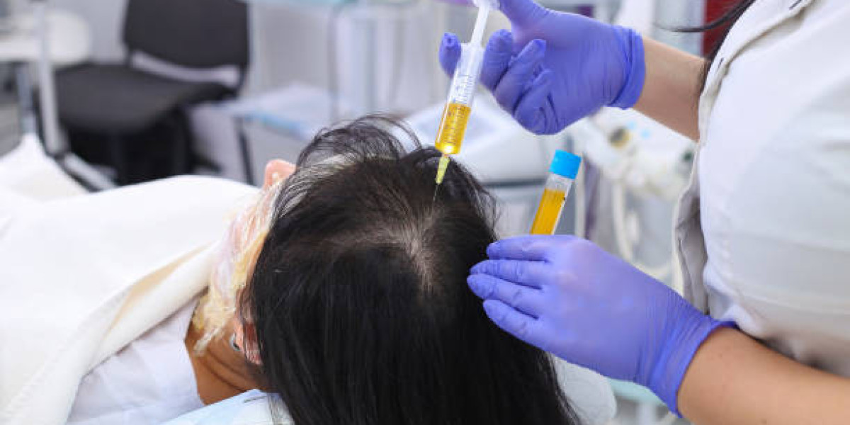 Combining PRP Hair Treatment With Other Hair Therapies