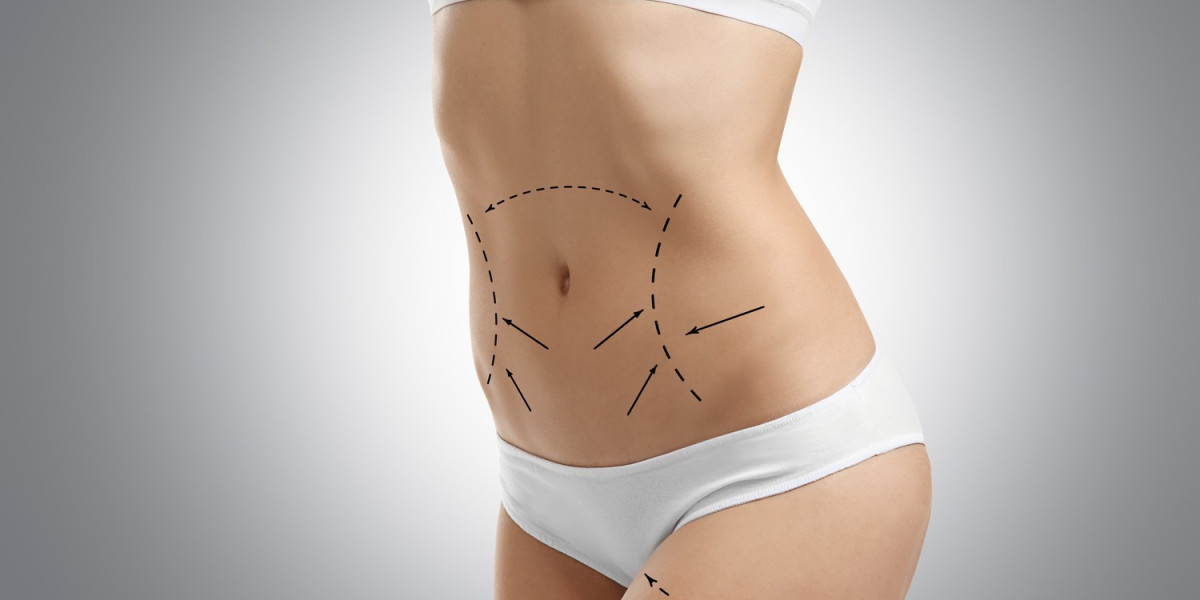 Liposuction for Thighs and Hips in Riyadh Details