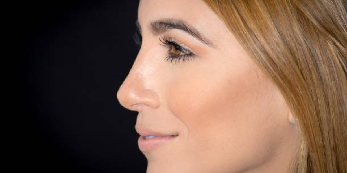 Rhinoplasty and Smiling: Natural Expression After Healing
