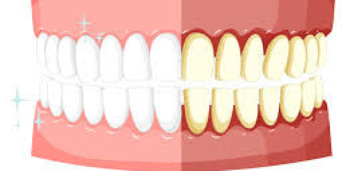 Healthy vs Unhealthy Gums Key Signs You Should Know