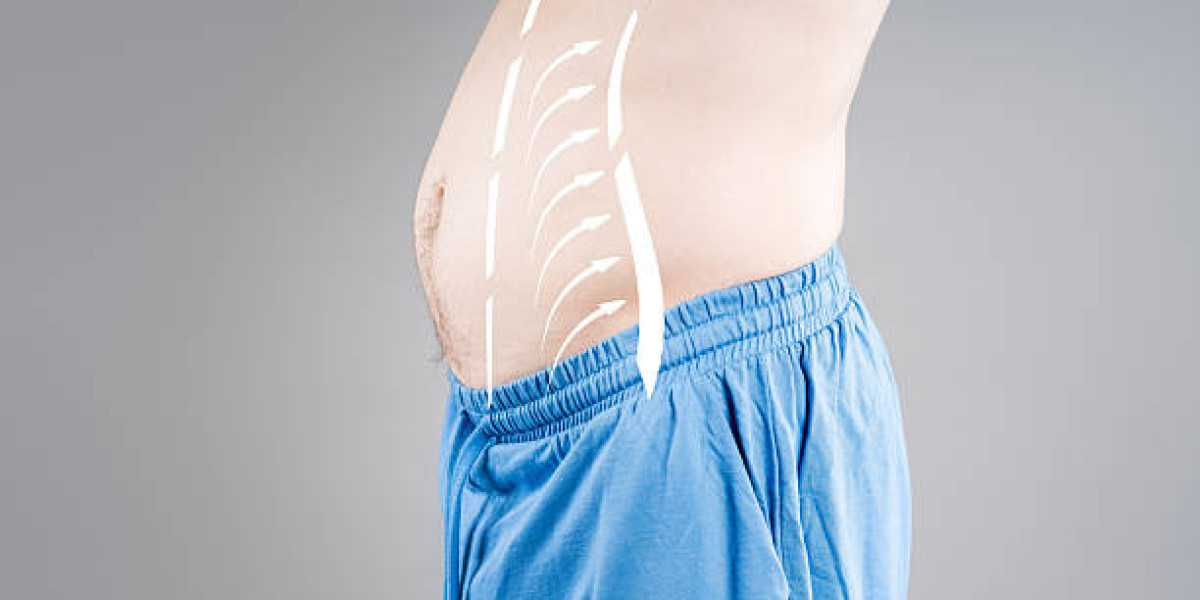 The Science Behind Liposuction Surgery: Fat Removal Demystified