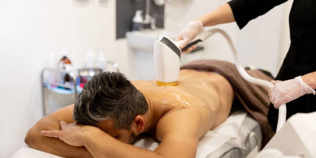 Key Factors to Consider Before Opting for Laser Hair Removal