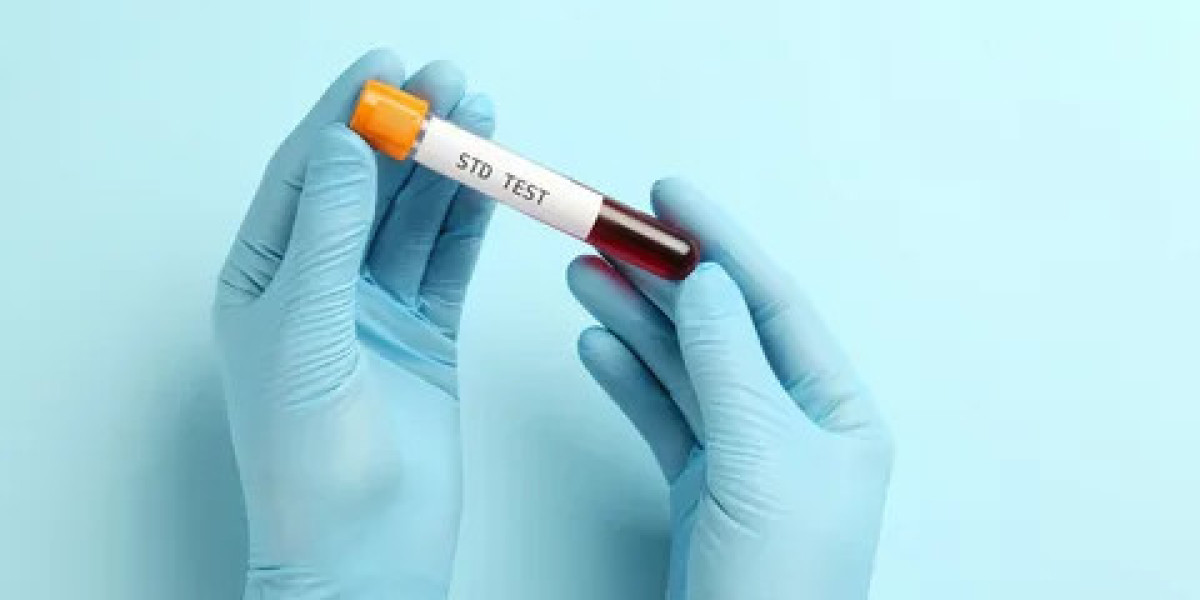 STD Test in Dubai: The Science of Detecting Silent Infections
