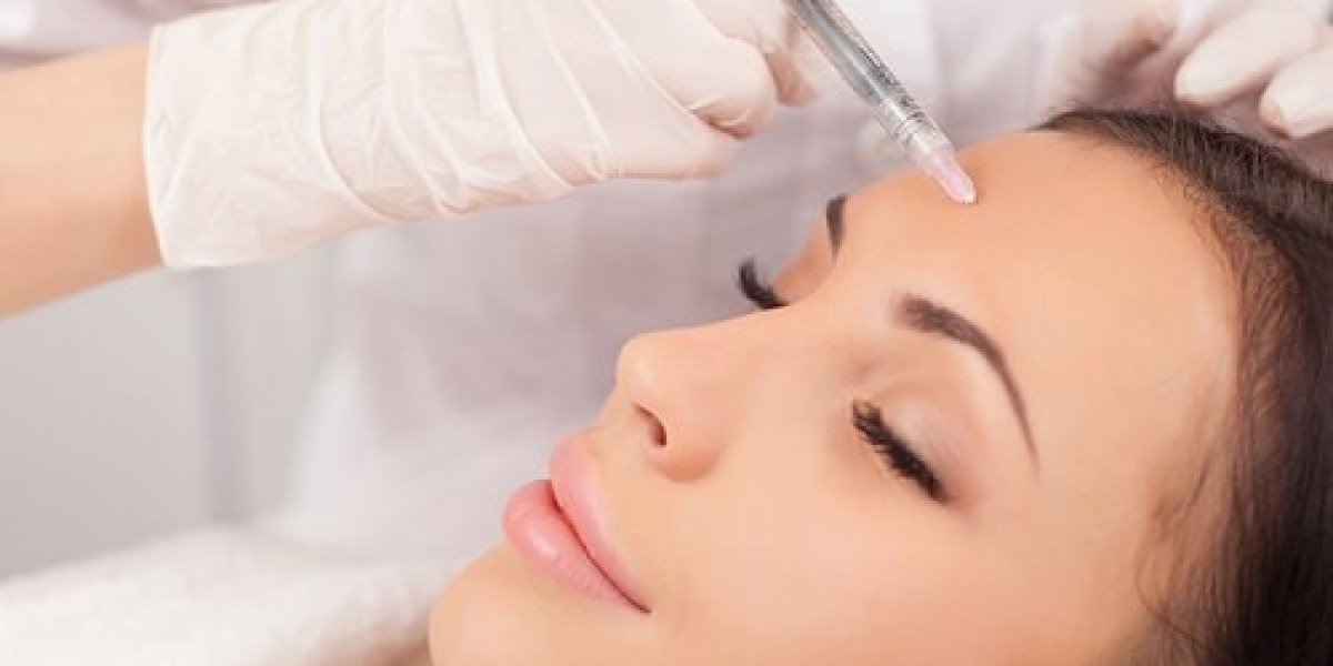 The Science Behind Mesotherapy in Islamabad