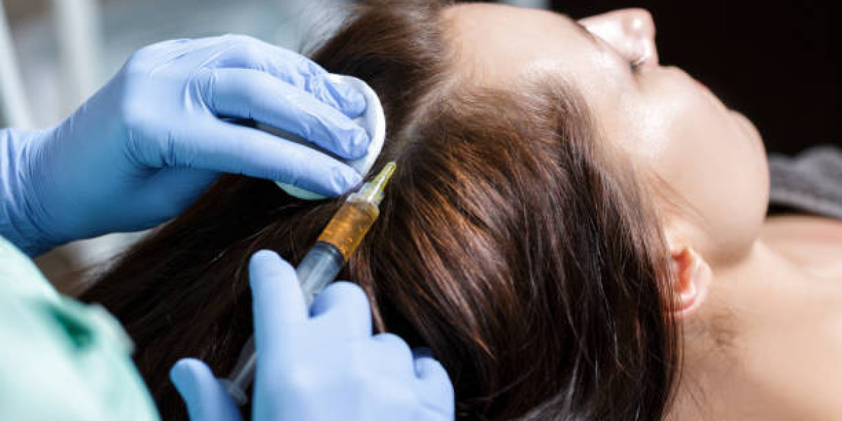 PRP Hair Treatment: A Natural Path to Restoring Confidence
