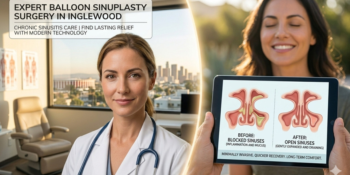 Where Can You Find Expert Balloon Sinuplasty Surgery in Inglewood for Chronic Sinusitis Care?