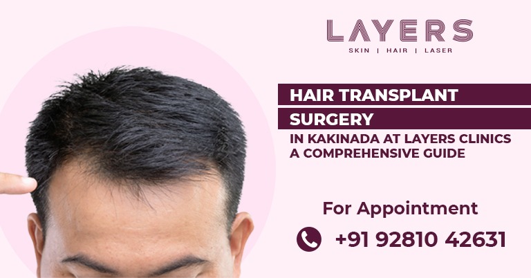 Hair Transplant Surgery in Kakinada - Layers Clinics
