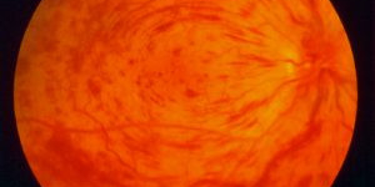 Retinal Vein Occlusion Market Size, Trends, and Strategic Outlook 2026-2033