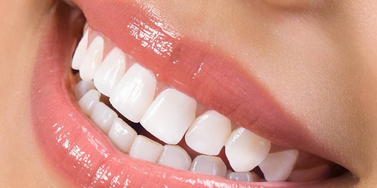 Refresh Your Glow with the Best Teeth Whitening in Dubai