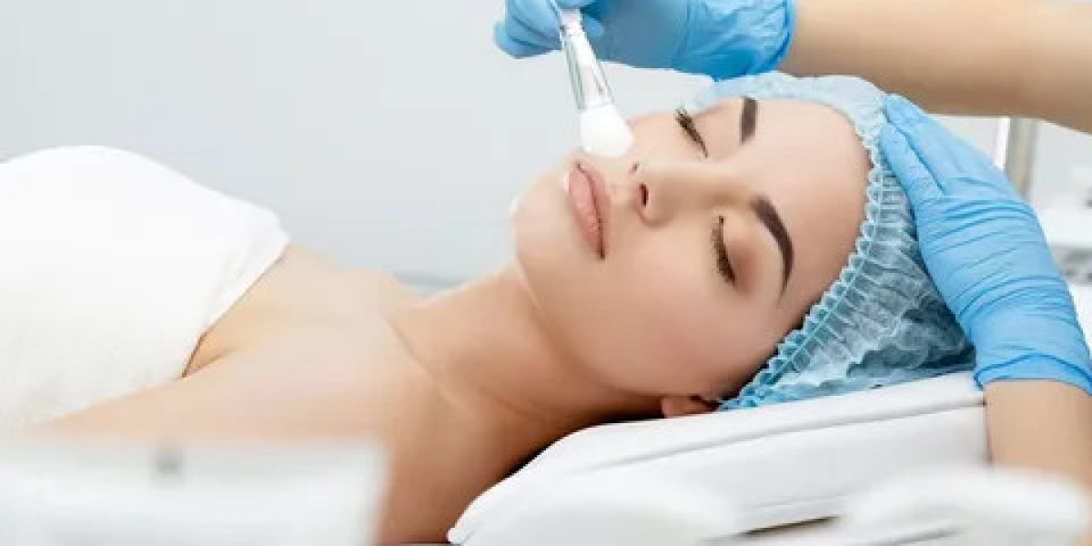 Chemical Peel Dubai: Targeted Therapy for Fine Lines & Wrinkles