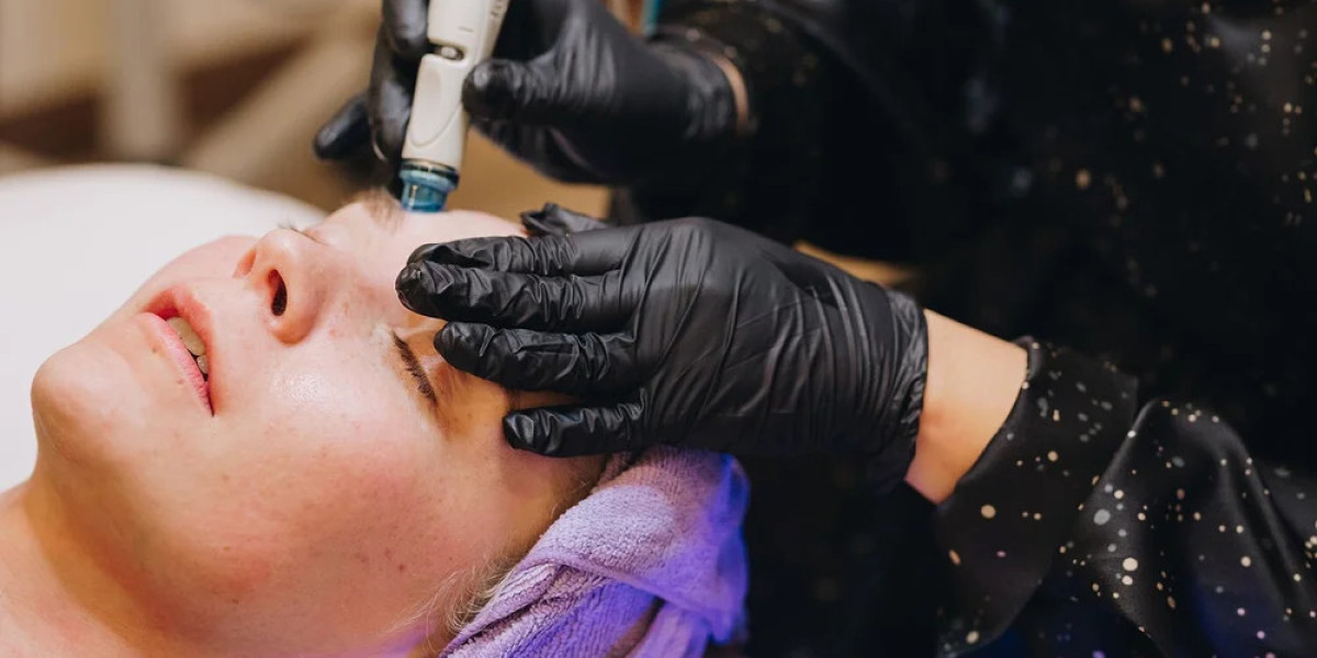 How Does Treatment Depth Change Fractional CO2 Laser Treatment Cost in Dubai