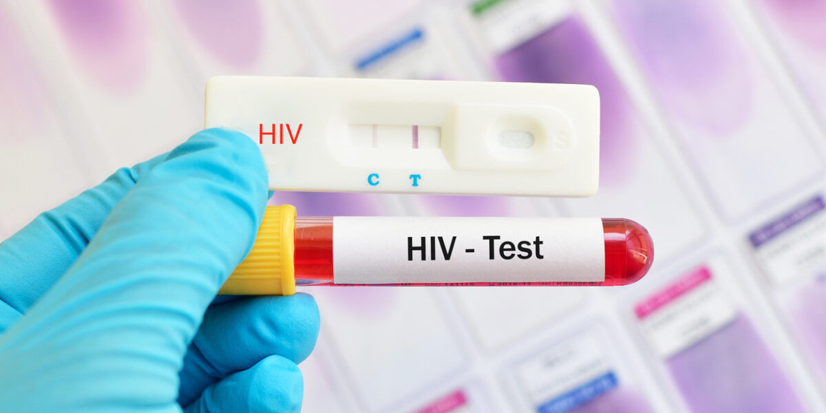 At-Home HIV Test Kits: Privacy, Convenience, and Empowerment
