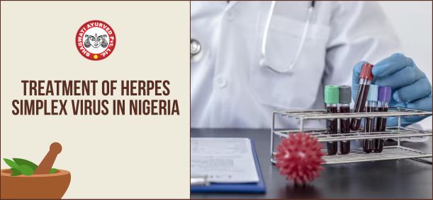 Treatment of Herpes Simplex Virus in Nigeria - Bhagwati Ayurved