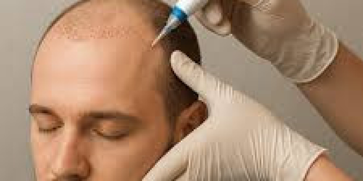 Non-Surgical Hair Restoration Options in Abu Dhabi: Modern Solutions for Thicker, Healthier Hair