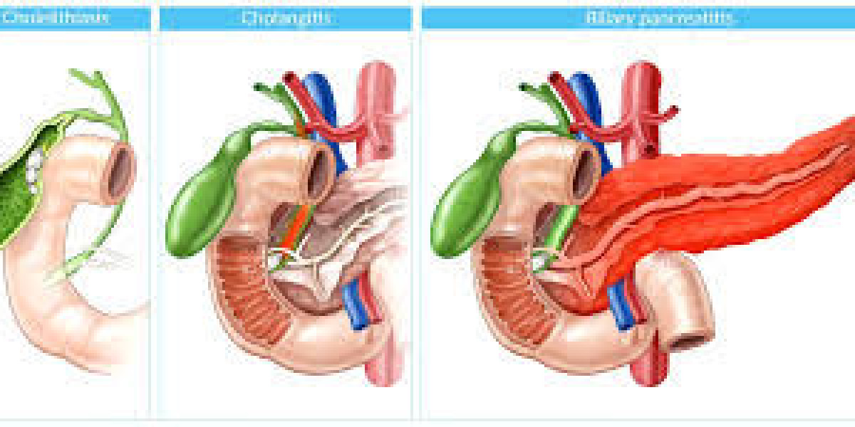 Patient Guide to Biliary Tract and Liver Surgery in Dubai: What to Expect Before and After Treatment