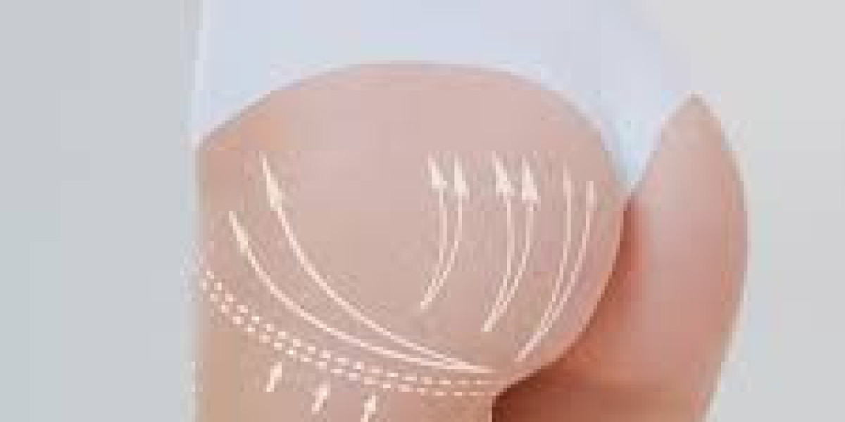Customized Buttock Lift Treatments Dubai – Enhance Your Curves Safely
