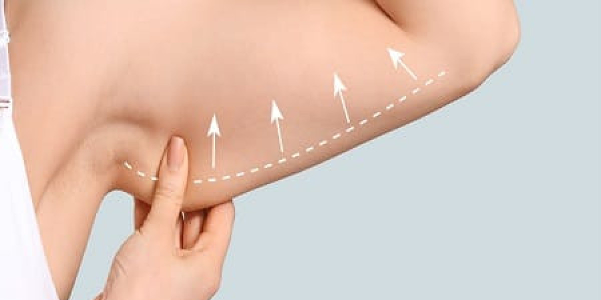 J Plasma Skin Lifting Specialist Dubai – Advanced Skin Tightening Solutions