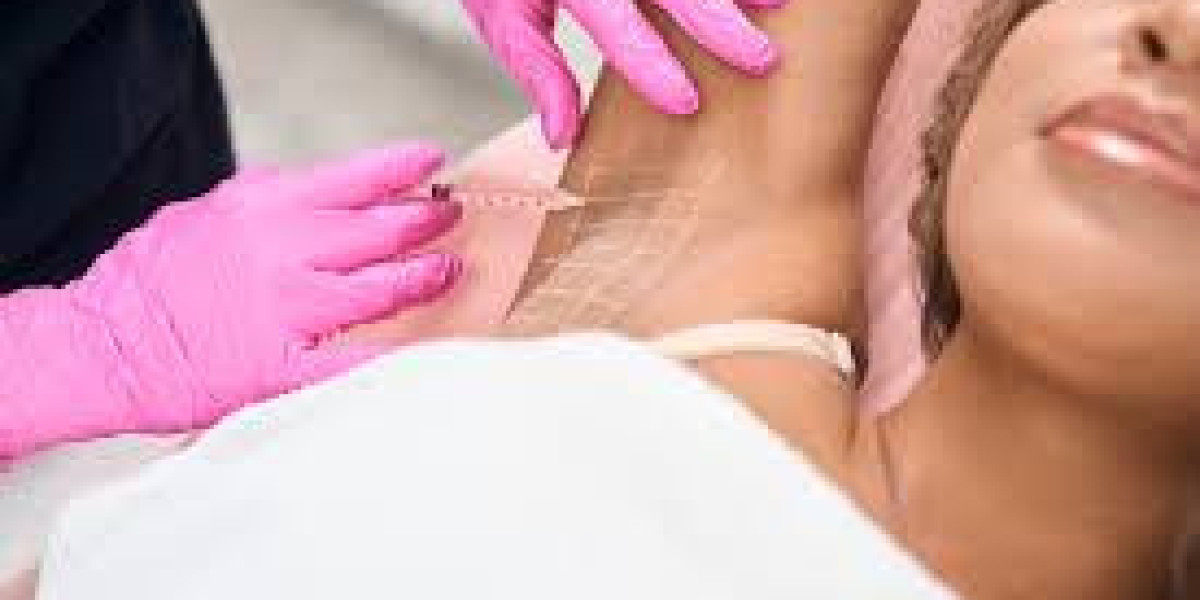 Comprehensive Guide to Minimally Invasive Hyperhidrosis Procedures in Dubai