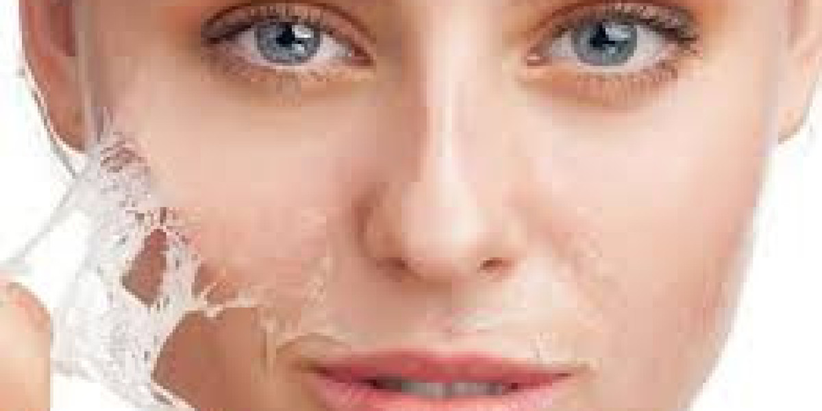 Skin Exfoliation with Glycolic Peel Dubai – Reveal Radiant, Smooth, and Clear Skin Naturally