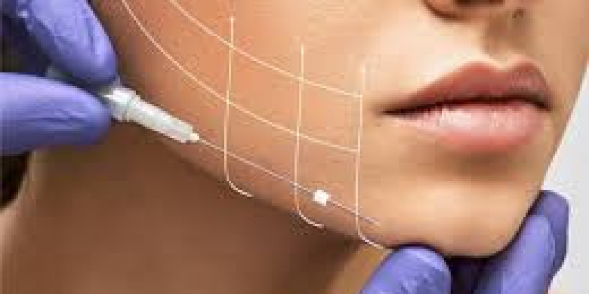 Thread Lift in Dubai – Subtle Facial Rejuvenation for Natural-Looking Lift and Firmness