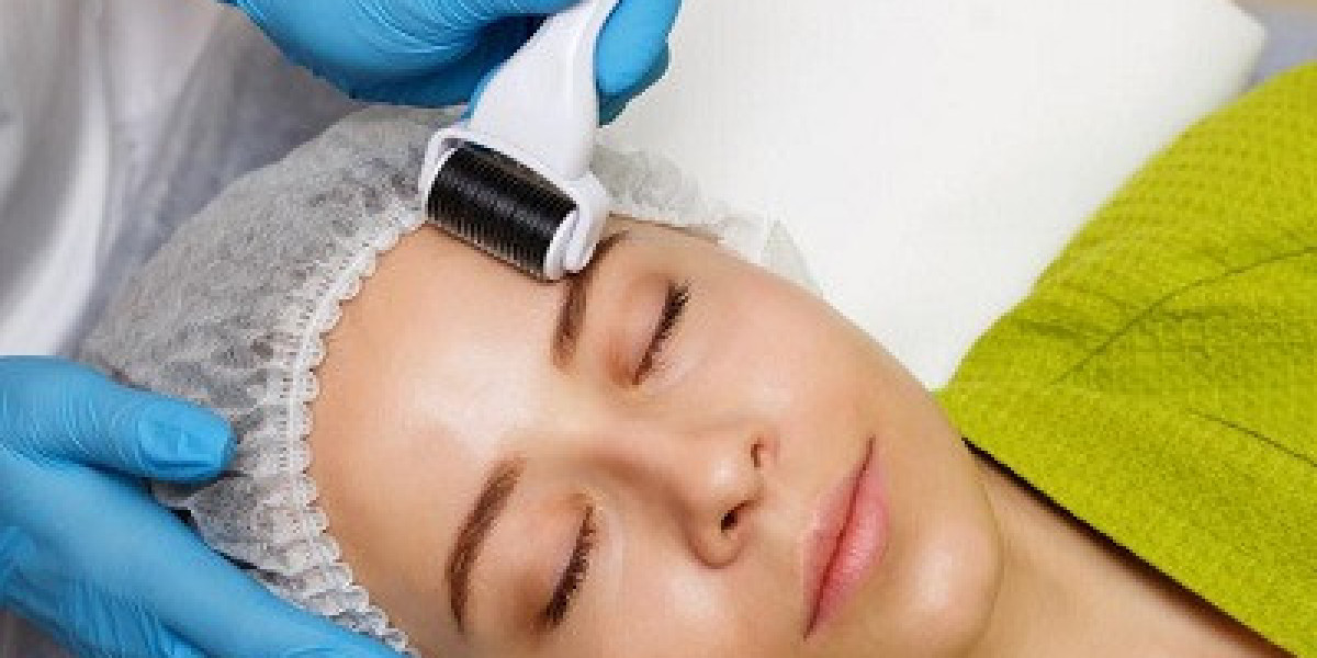 Derma Roller Therapy for Hyperpigmentation in Dubai – A Complete Skin Renewal Guide