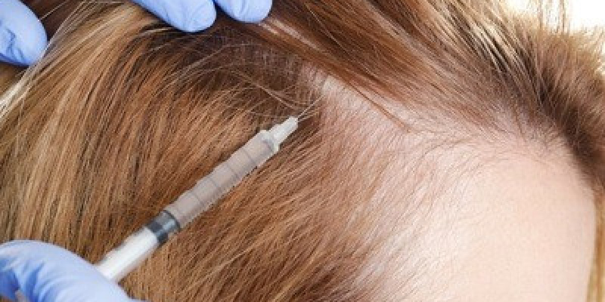 PRP Hair Therapy for Women in Abu Dhabi – A Natural Solution for Hair Restoration