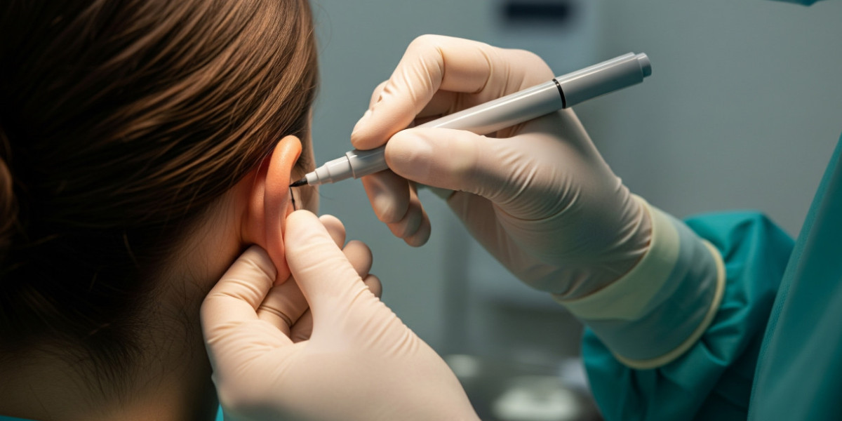 Understanding Ear Reshaping Options and Recovery