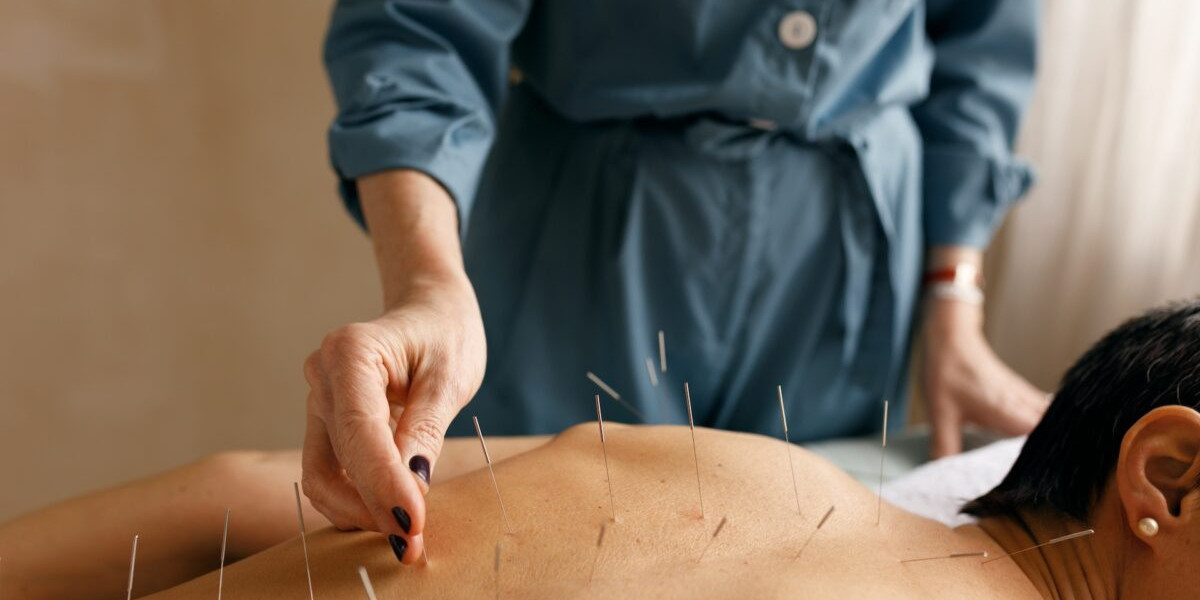 Benefits of Choosing Acupuncture for Pain Management in Philadelphia