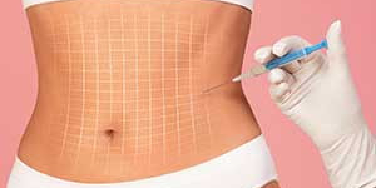 Why People Prefer Fat Melting Injection in Dubai for Facial Contouring and Definition
