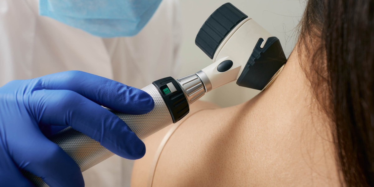When Are Results Visible in Mole Removal in Dubai?