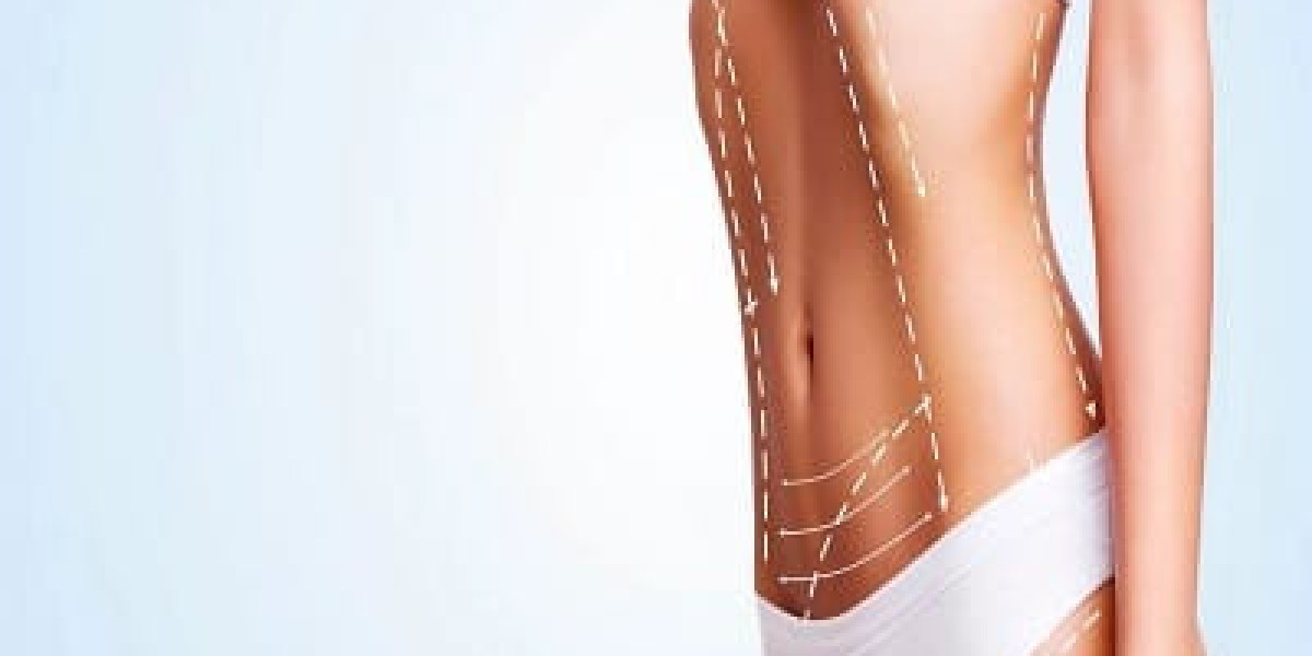 Transform Your Body with Dubai Liposculpture for Waist and Hips