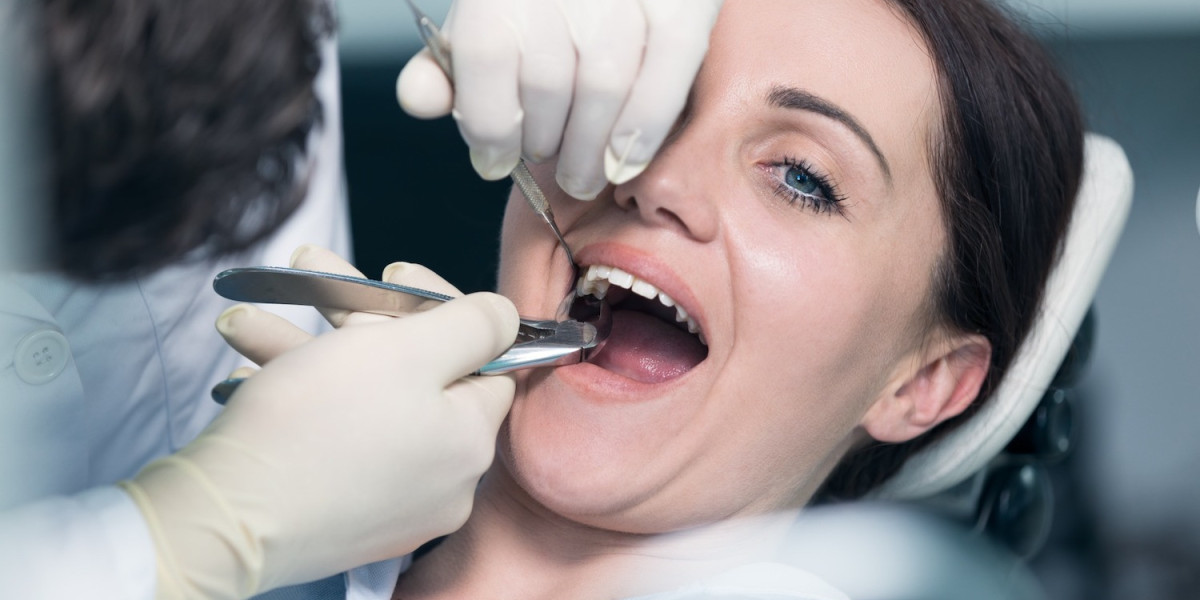 What Do Locals Say About Tooth Removal in Dubai