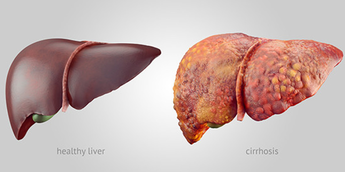 Liver Complex UK Review: Ingredients, Benefits & Real Results Explained