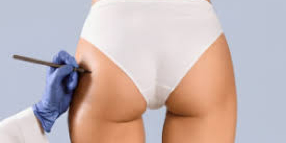 Best Reviews for Buttock Lift in Dubai: Patient Experiences, Results & Safety Insights