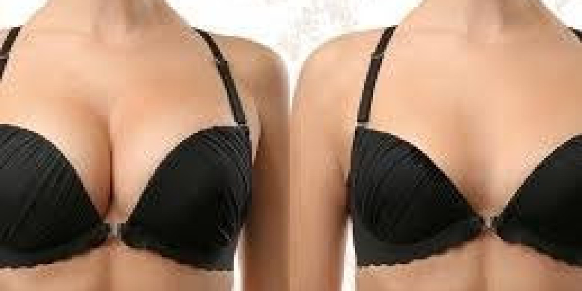 Dubai Surgical Centers for Breast Reshaping – Complete Guide to Modern Breast Contouring Options