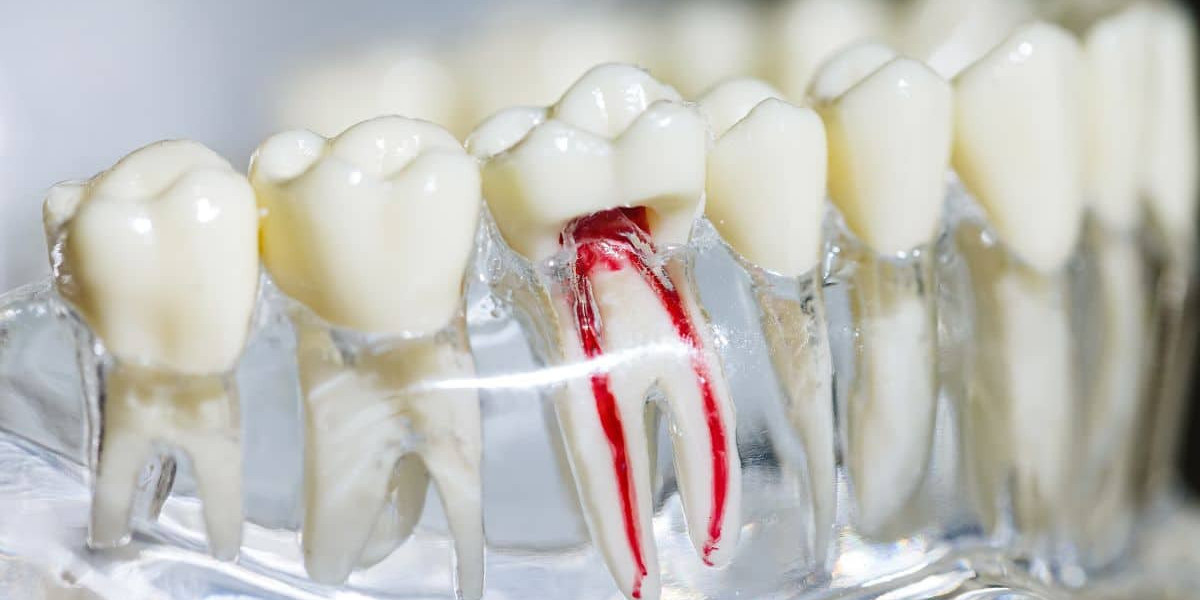 Tooth Pain and Root Canal Treatment: What’s the Connection?