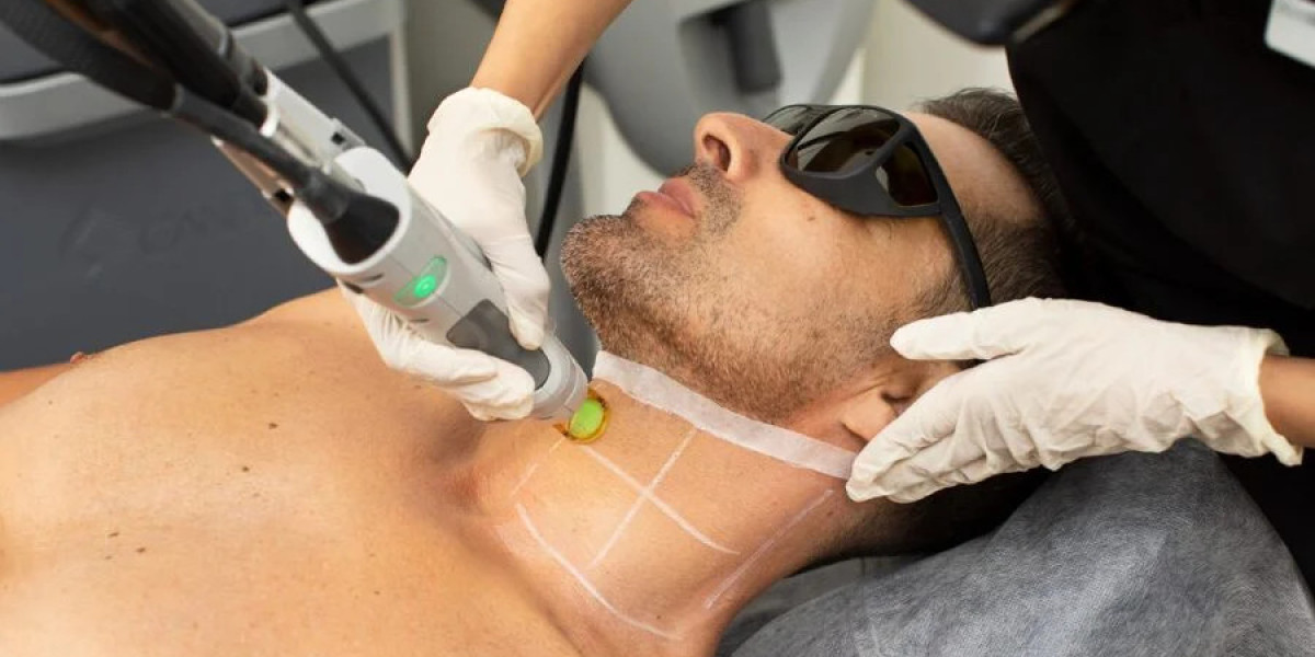 Laser Hair Removal for Beginners: Common Mistakes to Avoid