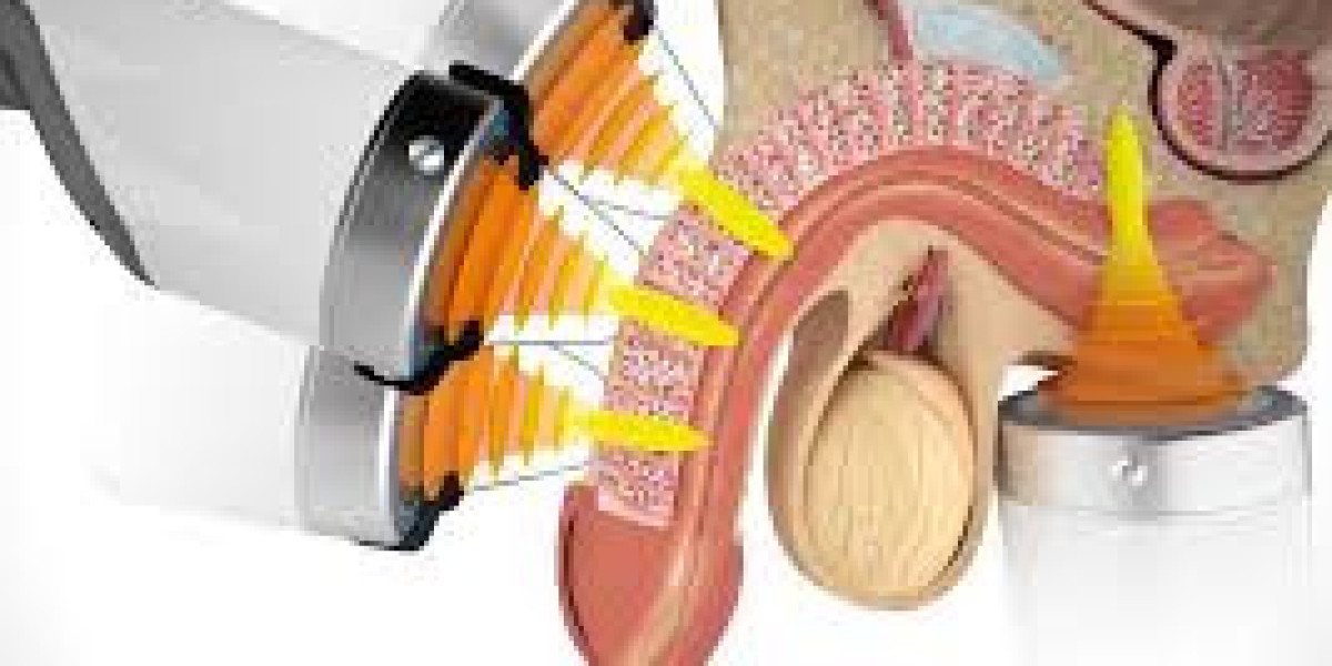 Why More Men Are Seeking Erectile Dysfunction Treatment in Dubai