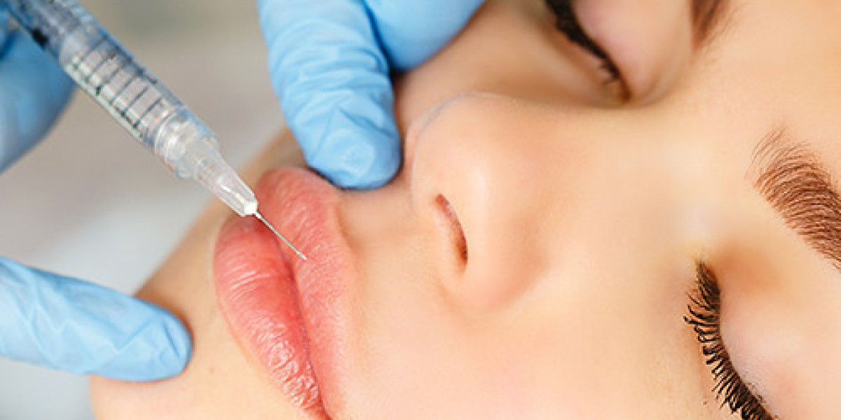 Subtle Beauty Changes with Lip Fillers Injections in Dubai – Natural Enhancement Guide
