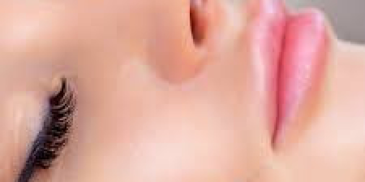 Fillers in Dubai – Modern Non-Surgical Facial Enhancement for Natural Beauty
