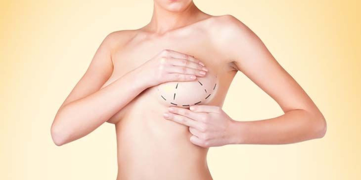 Understanding Breast Reduction in Dubai: Who Is the Ideal Candidate?