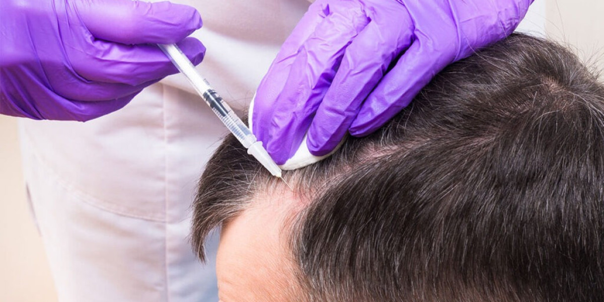 Why DHI Hair Transplant Is Popular for Natural-Looking Hair Results