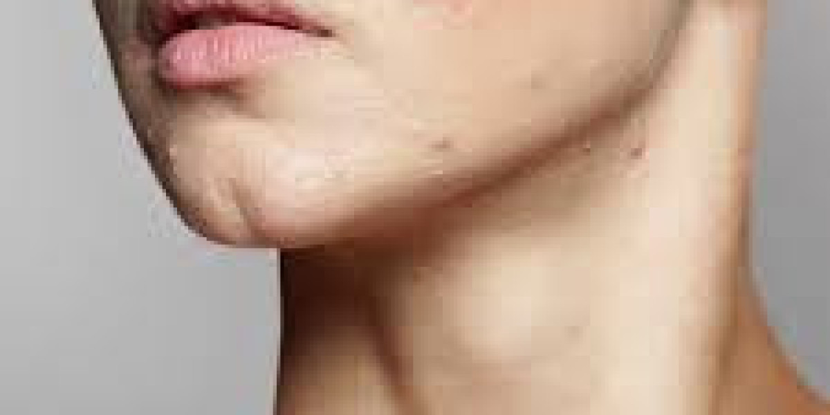 Scar Removal in Dubai: Skin Renewal Insights