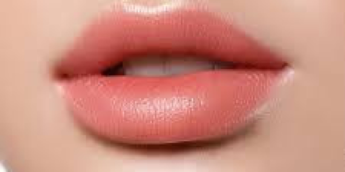 Russian Lip Filler in Dubai for Elegant and Lifted Lips